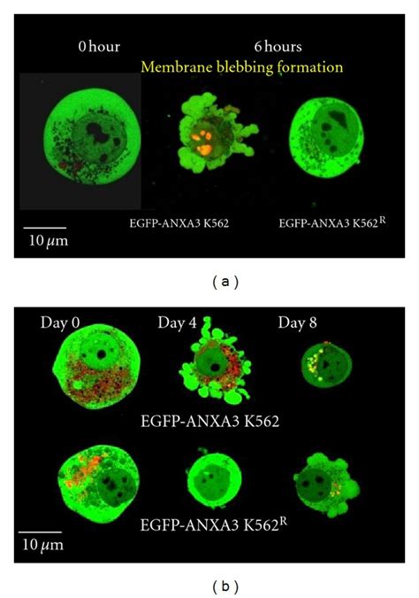 Common morphology between K562 cells after MnCl2 and haemin treatments ...