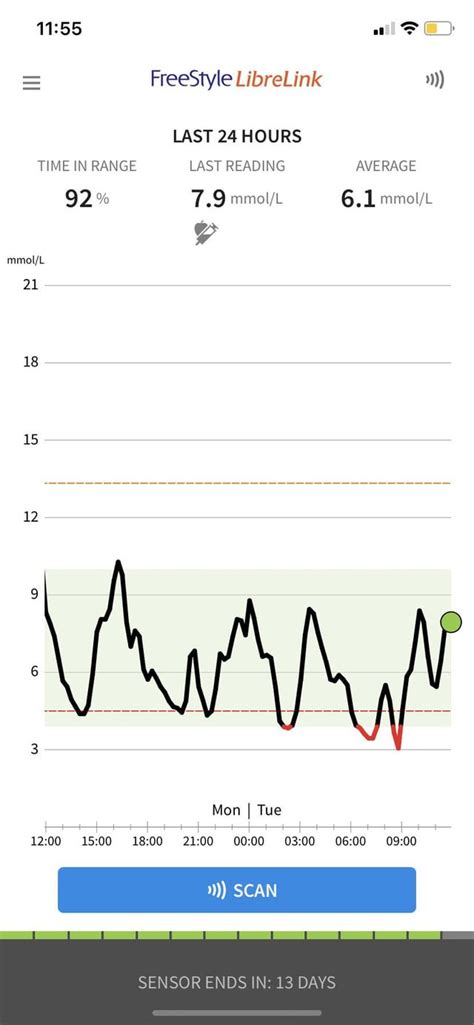 first CGM results! : r/Type1Diabetes