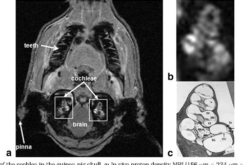 Figure 1 from Markers of cochlear inflammation using MRI. | Semantic Scholar