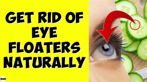 How To Easily Get Rid of Eye Floaters Naturally At Home | Eye floaters ...