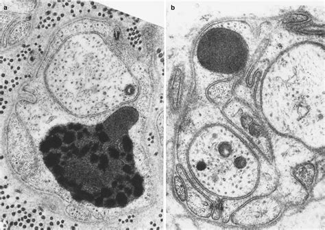 Schwann Cells and Myelin in the Peripheral Nervous System | Neupsy Key