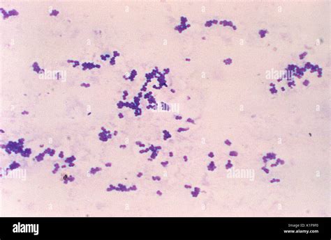 Enterococcus Faecalis Gram Stain Morphology