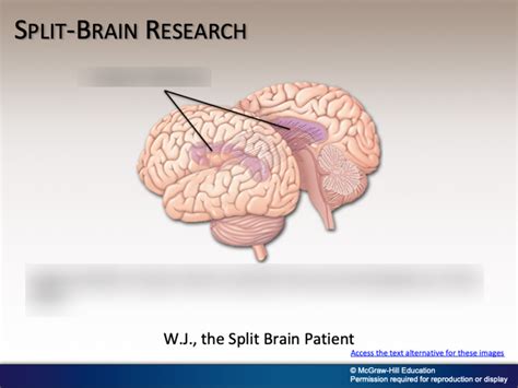 Split-Brain Research Diagram Diagram | Quizlet