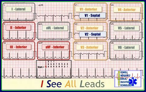 EKG: I See All Leads