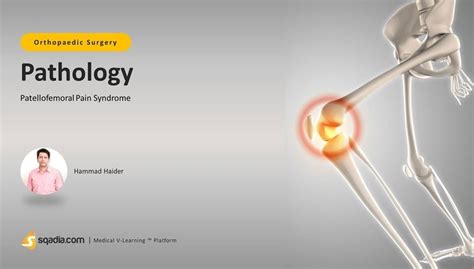 Patellofemoral Pain Syndrome - Pathology