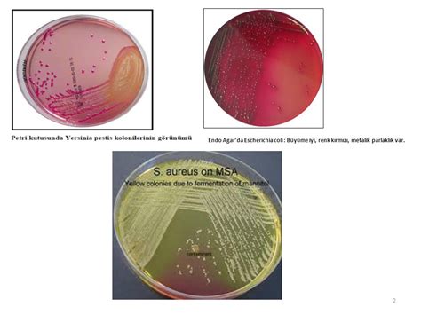 Hafnia alvei antibiotic treatment