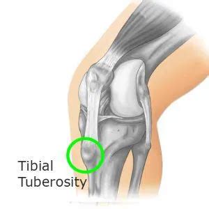 Tibial Tuberosity Anatomy - Structure, Function, Injury