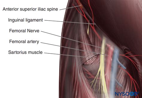 Femoral Nerve Block - Landmarks and Nerve Stimulator Technique - NYSORA