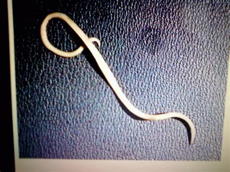 Vocabulary terms and pictures: nematode