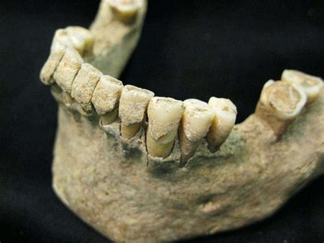 Microbial tomb discovered in 1,000 year-old human teeth