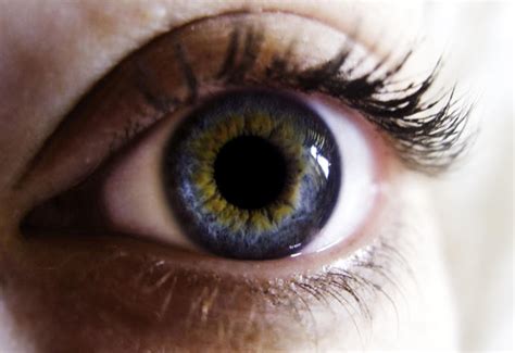 Why do some people's eyes have an orange/gold/yellow ring around the pupil? - GirlsAskGuys