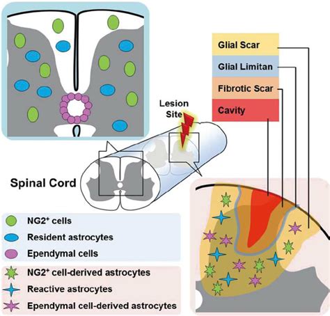 Day 205: Know your spinal cord – Glial scarring | Lunatic Laboratories