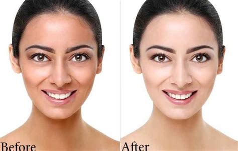 skin-lightening-creams-before-after - Skin Whitening Guides