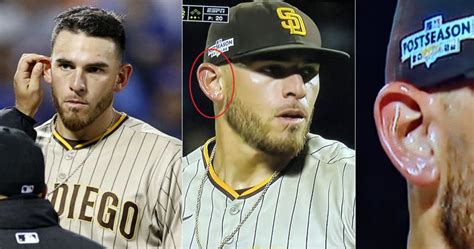 Padres Star Joe Musgrove’s Mystery Substance Identified (Photos) - Game 7