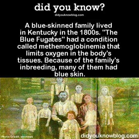 Blue-skinned Family | Kentucky, Weird facts, Family living