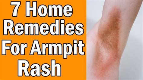 How To Heal Armpit Rashes In 2020 Armpit Rash Remedies Home Remedies | Images and Photos finder