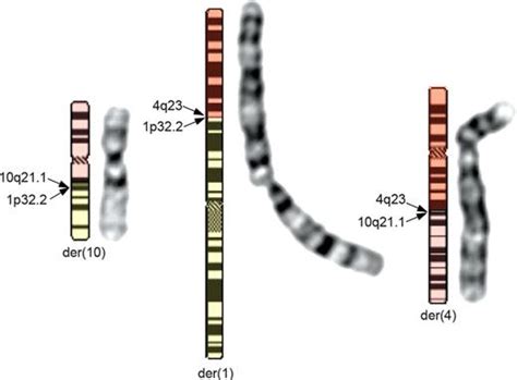 Chromothripsis as a mechanism driving complex de novo structural rearrangements in the germline ...