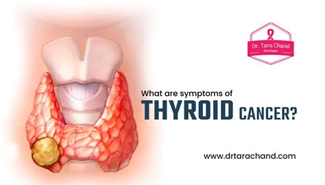 What are the Symptoms of Thyroid cancer? | Dr. Tara Chand Gupta