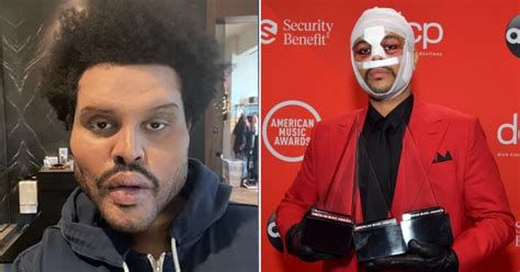 The Weeknd's face bandages reflection of ‘absurd culture of Hollywood ...