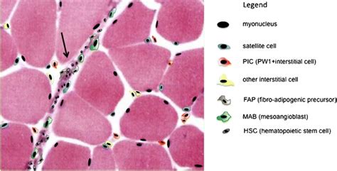 Sources for skeletal muscle repair: from satellite cells to ...