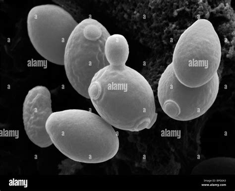 This is a false coloured scanning electron micrograph of Saccharomyces ...