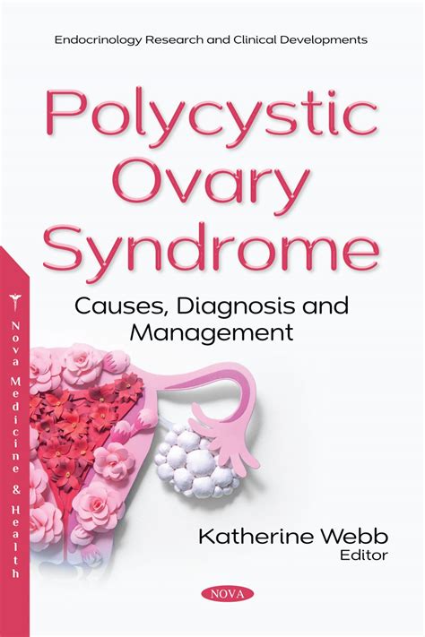 Polycystic Ovary Syndrome: Causes, Diagnosis and Management – Nova ...