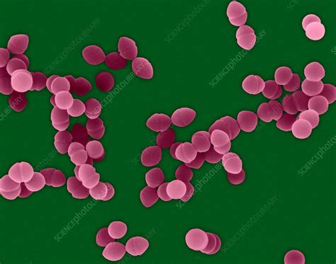 Enterococcus faecium, SEM - Stock Image - C032/2605 - Science Photo Library