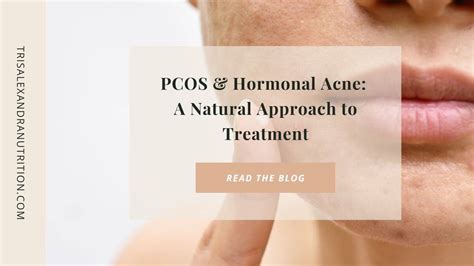 PCOS & Hormonal Acne: A Natural & Nutritional Approach to Treatment