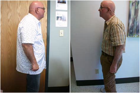 Jerry lost 75 pounds thanks to Riverside Spine & Physical Medicine ...