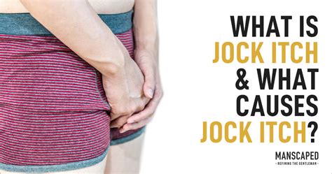 What is Jock Itch and What Causes Jock Itch? – Manscaped