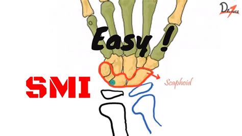Skeletal maturity indicators | Hand-wrist Anatomy| - YouTube