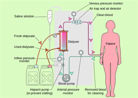 Dialysis- Dialysis Meaning, Dialysis Machine & Procedure