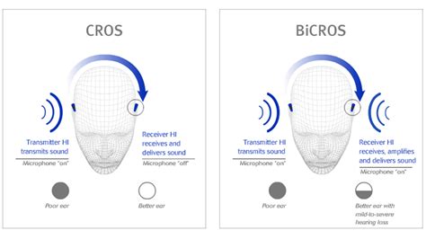 What is a Cros hearing aid? | Claso