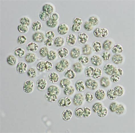 Microcystis aeruginosa ~ Everything You Need to Know with Photos | Videos