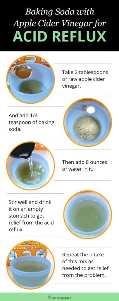 3 Best Baking Soda Methods for Acid Reflux