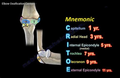 Elbow Ossification Centers — OrthopaedicPrinciples.com