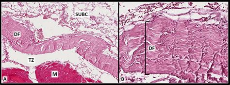 Histology of the deep fascia. Deep fascia (DF) is an anatomical ...