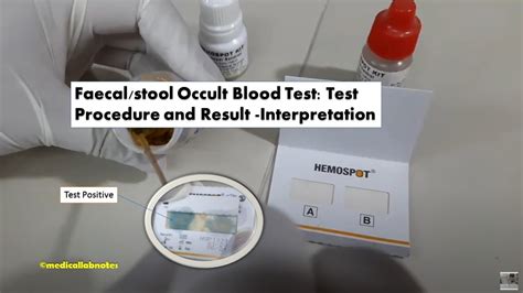 Fecal Occult Blood Test Methods, Principle, Procedure,, 41% OFF