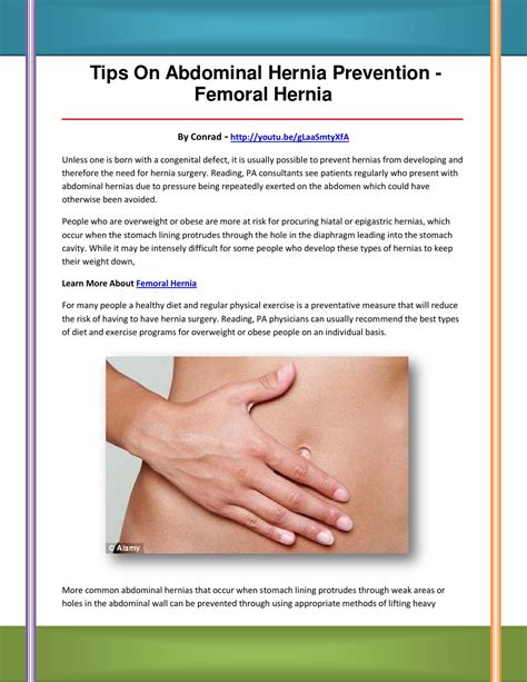 Femoral hernia by fbgchbnmgj - Issuu