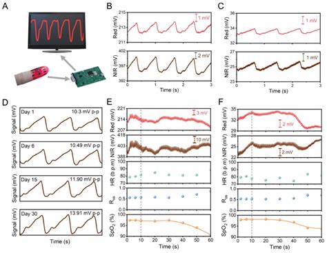 Skin‐integrated PPG sensor. A) Schematic of the PPG measurement setup ...