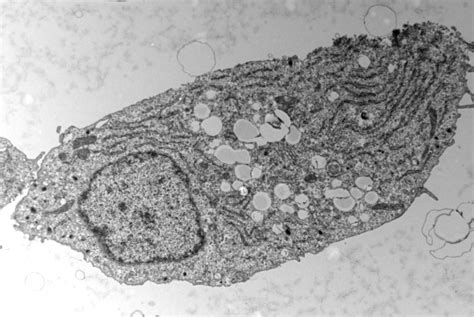 Fat Cycle Helps Pancreatic Beta Cells Adapt to Excess Sugar