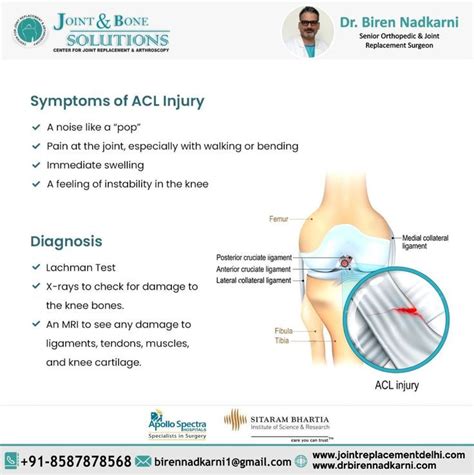 Symptoms of an ACL injury