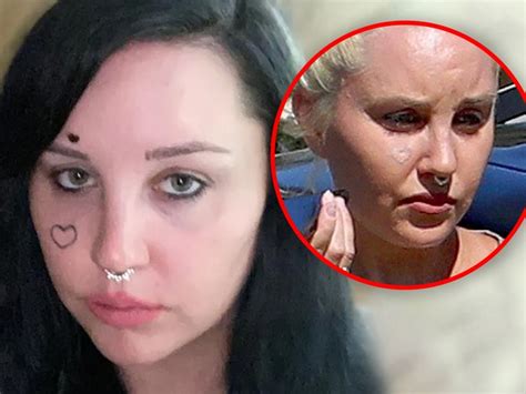 Amanda Bynes Appears to Be Removing Face Tattoo After Mental Health ...