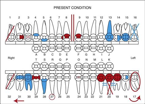 12. The Dental Examination | Pocket Dentistry | Dental charting, Dental assistant study, Dental