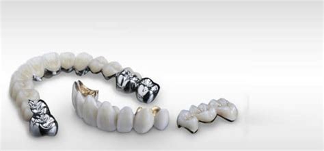 Zirconia Crowns Advantages and Disadvantages - Keating