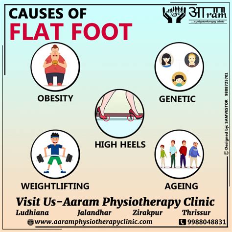 FLAT FOOT- Definition, Symptoms, Causes & Rehabilitation Exercises