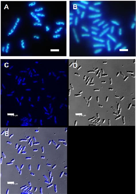 Fluorescence microscopy and confocal laser scanning microscopy images ...