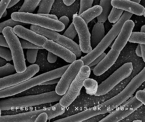 E. coli Bacteria | Scanning electron micrograph of Escherich… | Flickr