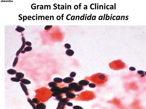 PPT - Gram Stain of a Clinical Specimen of Candida albicans PowerPoint ...