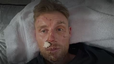 Freddie Flintoff reveals extent of injuries after Top Gear crash | Ents & Arts News | Sky News